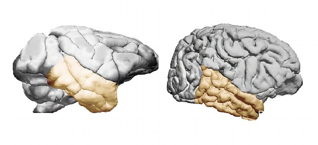 Cerebro homínido